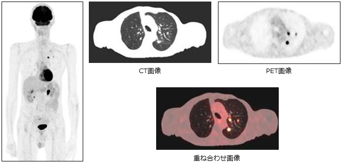 放射線科部2