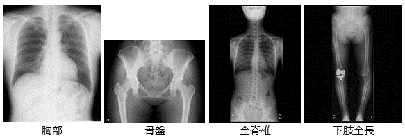 一般撮影