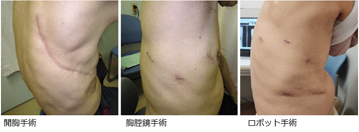 呼吸器外科1 W700